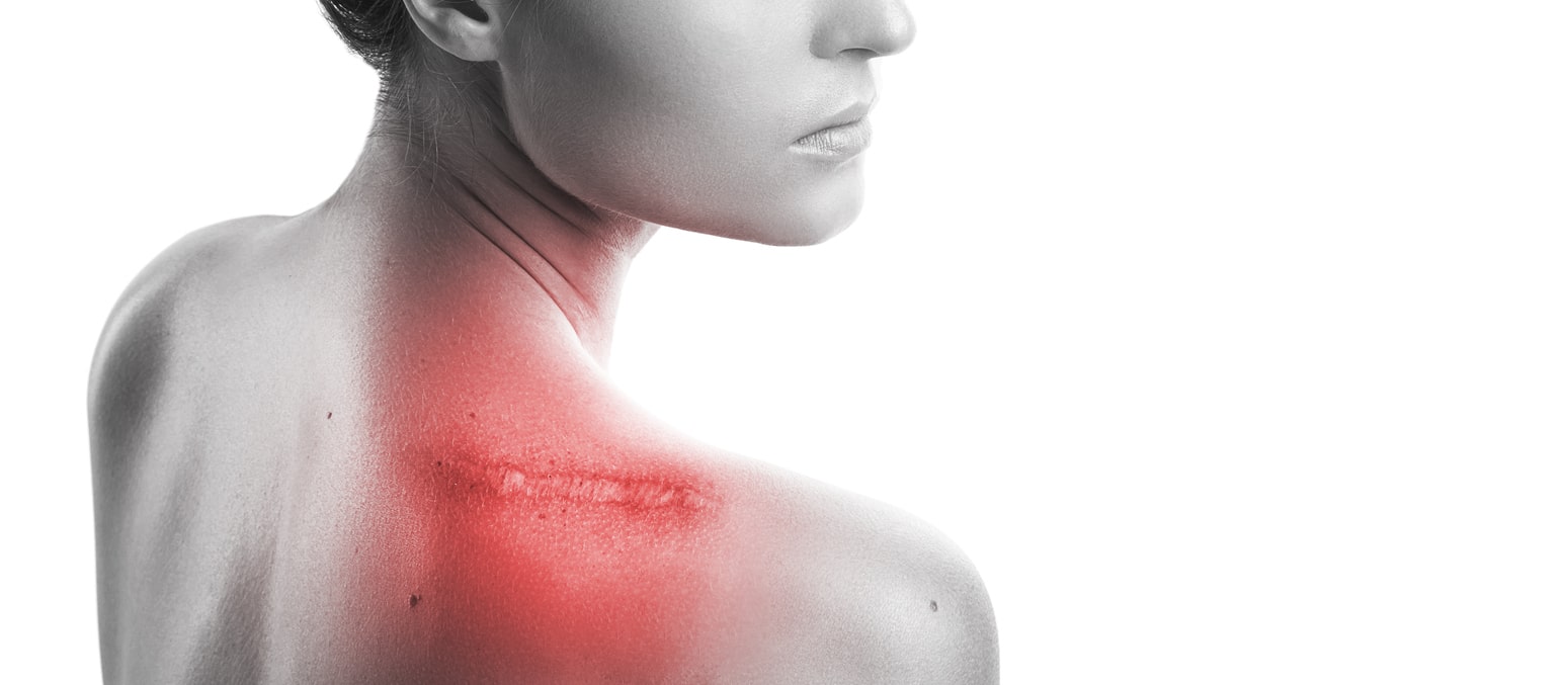 Woman With A Scar On Her Shoulder Lit Up With Red Light